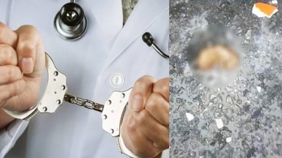 قضية الاجنة