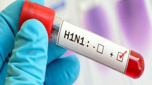 نقابة الصيدليات الخاصة: الفترة الحالية تشهد انتشارا كبيرا لأنفلونزا الخنازير