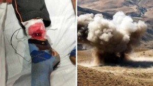 القصرين: إصابة طفل في انفجار لغم ارضي بجبل السلوم