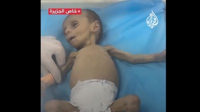 غزة: وفاة طفل بالمستشفى بسبب سوء التغذية وعدم توفر العلاج