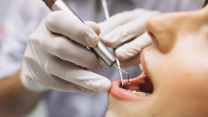 نقابة أطباء الأسنان تدعو إلى ضرورة إعادة تأهيل القطاع وإنشاء إدارة مركزية مستقلة