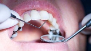 مختص في الاورام يدعو الى القيام بالفحص الدوري للفم والأسنان منذ الطفولة لتجنب عديد الأمراض