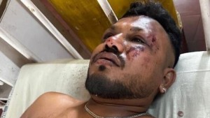 ناجٍ وحيد من تحطم طائرة الهند يروي تفاصيل لحظات الرعب