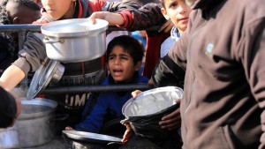 مدير الإغاثة الطبية بغزة: 17 ألف طفل يعانون من سوء تغذية شديد