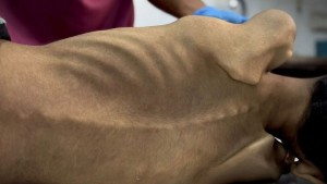 غزة: 10 شهداء بسبب المجاعة خلال 24 ساعة الماضية