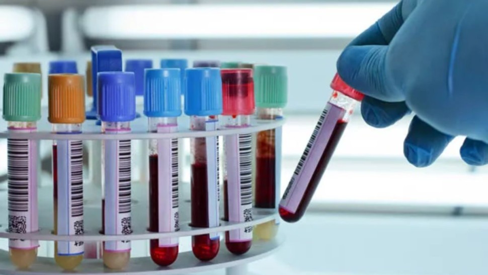 نقابة البيولوجيين الخواص تحذّر: تأخر ''الكنام'' في الخلاص يهدّد استمرارية المخابر