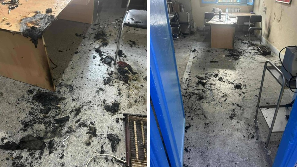 مستشفى الرديف: اصابة عاملة بحروق بليغة جرّاء تماس كهربائي