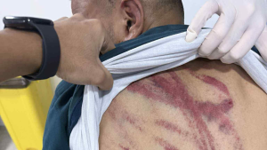 شاب تونسي يتعرّض للتعذيب في ليبيا