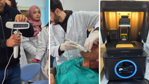 وزارة الصحة تعزّز طبّ الأسنان بنابل بتجهيزات رقمية متطورة