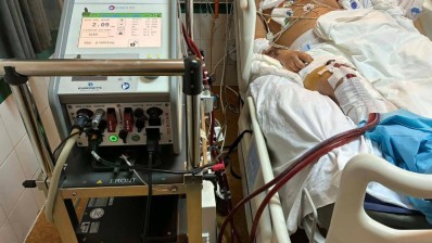 قلب ورئة خارج الجسد… تقنية متطورة تنقذ مريضًا في حالة حرجة بصفاقس