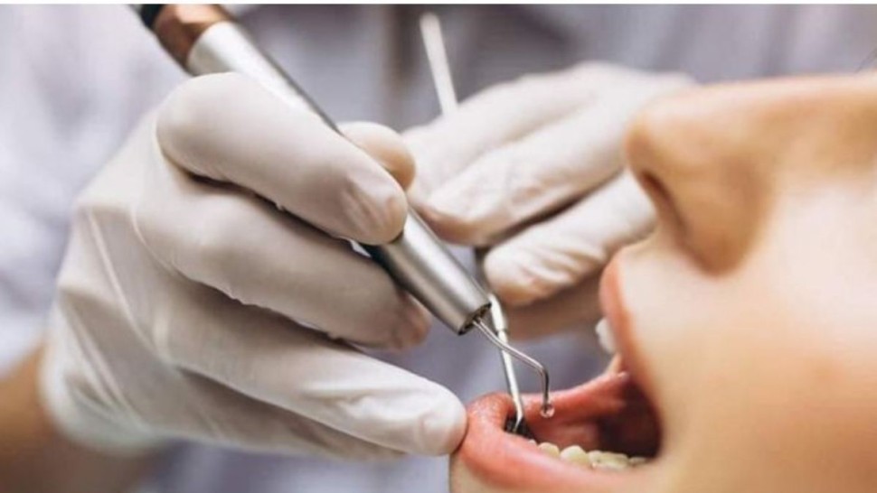 قفصة: انطلاق العيادات الليلية في طب الاسنان بعدة مؤسسات استشفائية