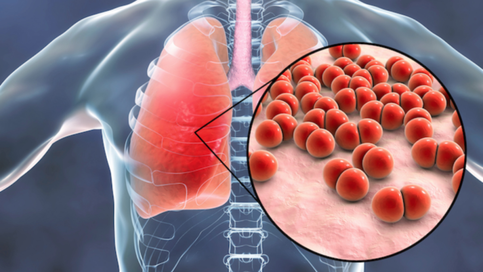 عميد الأطباء البيطريين: تونس تسجل سنويا نحو 1500 حالة سل عقدي