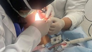 قفصة: لأول مرة نجاح عملية زرع لثة بالمستشفى المحلي بالمظيلة