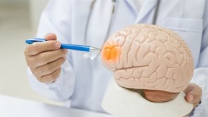 جمعية طبّ الأعصاب بالقطاع الخاص بصفاقس
